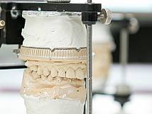 Detailaufnahme eines Gebiss-/Zahnmodells